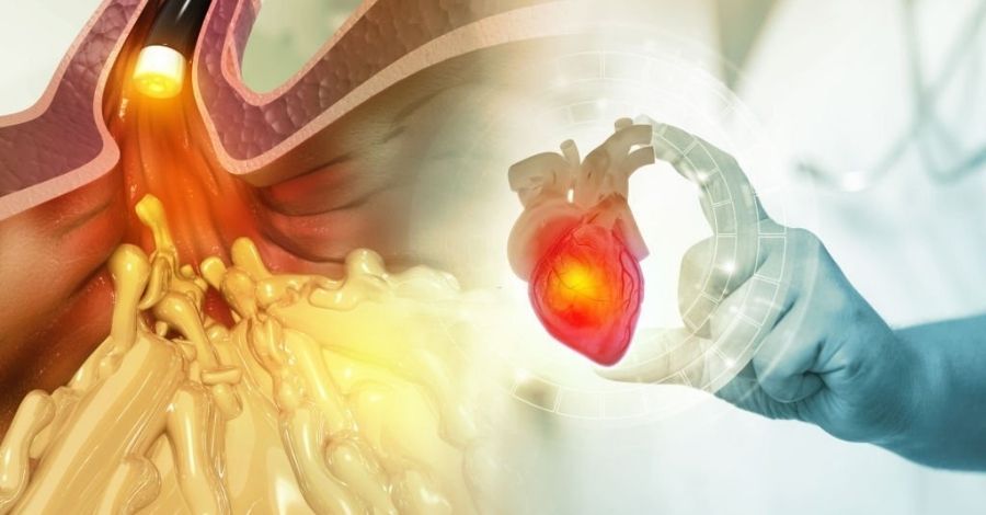 Coronary Angiography, Coronary Angiography Procedure, Coronary Angiography Treatment Procedure, Coronary Angiography Treatment Procedure Udaipur